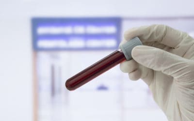Hashimoto’s Thyroid: More than just thyroid testing.